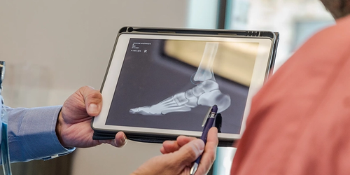 Podiatrist explaining an X-ray to a patient, focusing on foot health and treatment options.